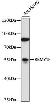 Western blot - RBMY1F Polyclonal Antibody 