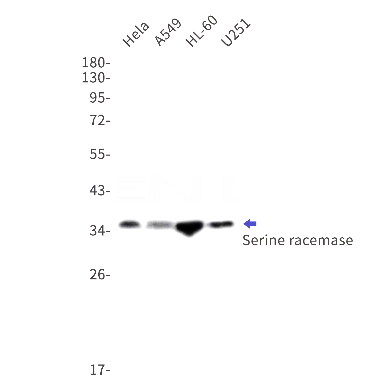 Western blot detection of Serine racemase in Hela,A549,HL-60,U251 cell lysates using Serine racemase Rabbit mAb(1:1000 diluted).Predicted band size:37kDa.Observed band size:37kDa.