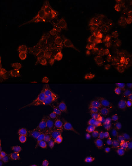 Immunofluorescence - B4GALT4 Polyclonal Antibody 