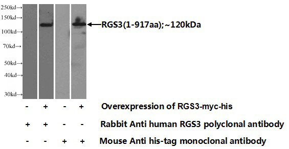 Transfected HEK-293 cells were subjected to SDS PAGE followed by western blot with Catalog No:114646(RGS3 Antibody) at dilution of 1:1000