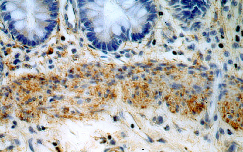 Immunohistochemical of paraffin-embedded human colon using Catalog No:111474(HMCN1 antibody) at dilution of 1:50 (under 40x lens)