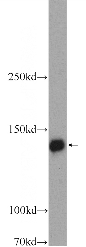 mouse brain tissue were subjected to SDS PAGE followed by western blot with Catalog No:116976(WWC2 Antibody) at dilution of 1:600