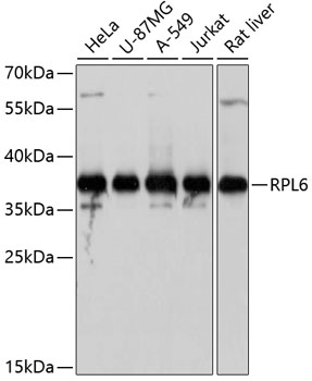 Western blot - RPL6 Polyclonal Antibody 