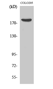 Fig1:; Western Blot analysis of various cells using MRCKβ Polyclonal Antibody