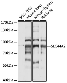 Western blot - SLC44A2 Polyclonal Antibody 