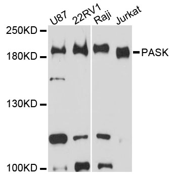 Western blot - PASK Polyclonal Antibody 