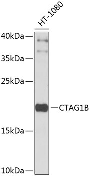 Western blot - CTAG1B Polyclonal Antibody 