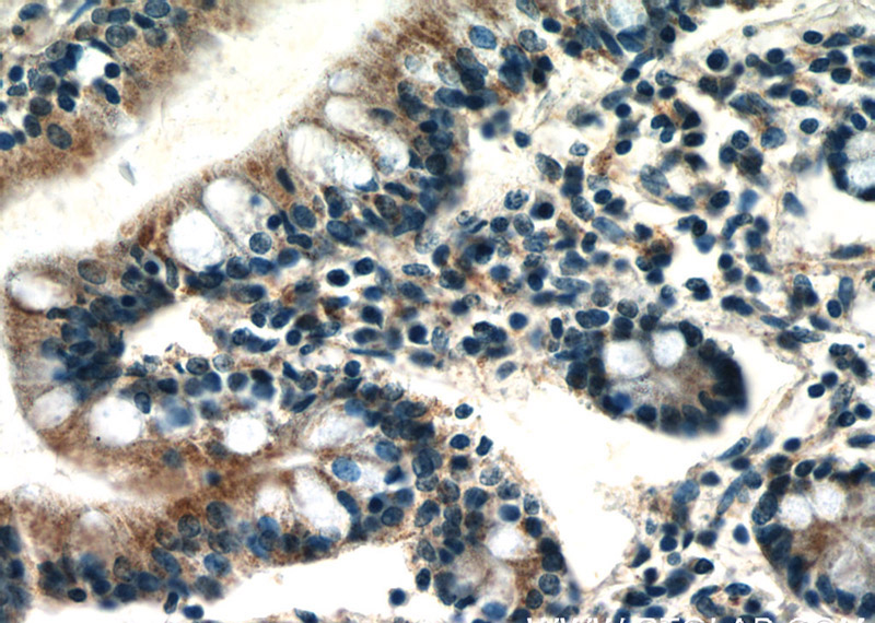 Immunohistochemistry of paraffin-embedded human small intestine slide using Catalog No:109633(CX3CL1 Antibody) at dilution of 1:50 (under 40x lens)