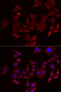 Immunofluorescence - NPHP1 Polyclonal Antibody 