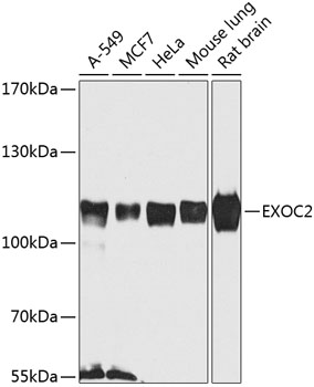 Western blot - EXOC2 Polyclonal Antibody 