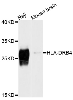 Western blot - HLA-DRB4 Polyclonal Antibody 