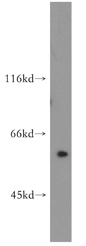 mouse heart tissue were subjected to SDS PAGE followed by western blot with Catalog No:114079(PPAN antibody) at dilution of 1:800