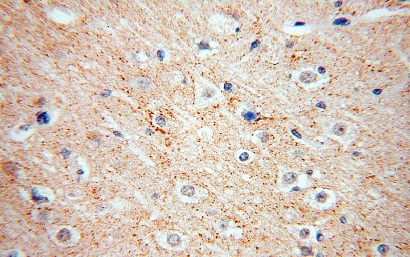 Immunohistochemical of paraffin-embedded human brain using Catalog No:114699(RIC8B antibody) at dilution of 1:100 (under 40x lens)
