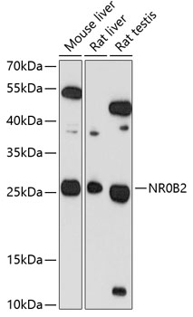 Western blot - NR0B2 Polyclonal Antibody 