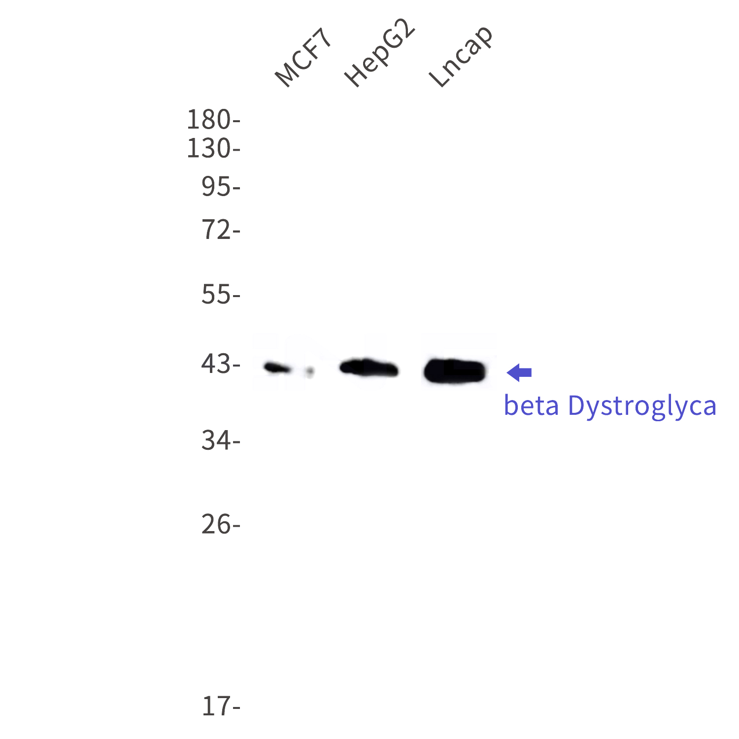 Western blot detection of beta Dystroglycan in MCF7,HepG2,Lncap cell lysates using beta Dystroglycan Rabbit mAb(1:1000 diluted).Predicted band size:27kDa.Observed band size:42-44kDa.