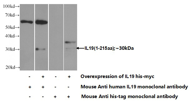 Transfected HEK-293 cells were subjected to SDS PAGE followed by western blot with Catalog No:107386(IL19 Antibody) at dilution of 1:1000