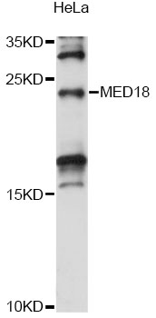Western blot - MED18 Polyclonal Antibody 