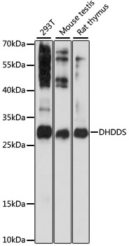 Western blot - DHDDS Polyclonal Antibody 