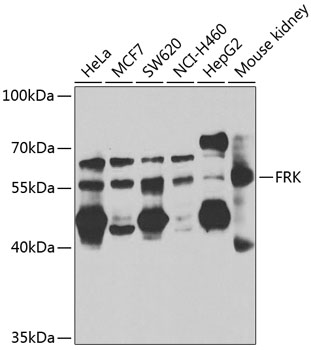 Western blot - FRK Polyclonal Antibody 