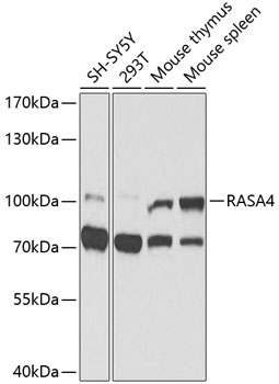 Western blot - RASA4 Polyclonal Antibody 