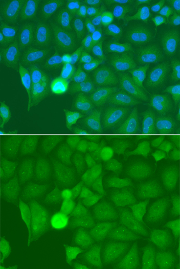Immunofluorescence - IRAK2 Polyclonal Antibody 