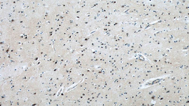 Immunohistochemical of paraffin-embedded human brain using Catalog No:117009(ZNF597 antibody) at dilution of 1:50 (under 10x lens)