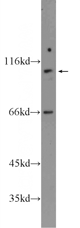 PC-3 cells were subjected to SDS PAGE followed by western blot with Catalog No:110574(FAM160B1 Antibody) at dilution of 1:600