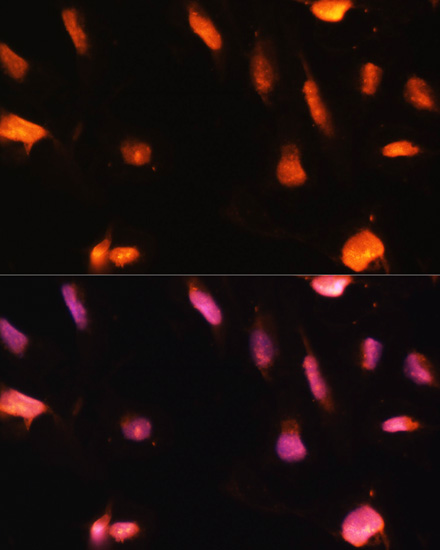 Immunofluorescence - ZNF416 Polyclonal Antibody 