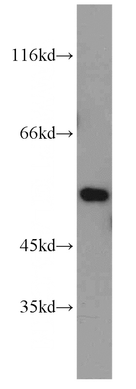 mouse lung tissue were subjected to SDS PAGE followed by western blot with Catalog No:110728(FMO2 antibody) at dilution of 1:800