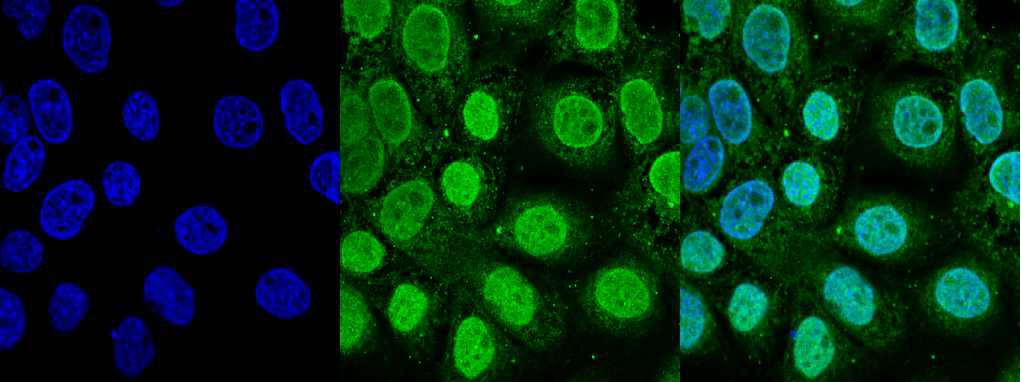 Fig2: ICC staining TOP2A in A431 cells (green). Cells were fixed in paraformaldehyde, permeabilised with 0.25% Triton X100/PBS and counterstained with DAPI in order to highlight the nucleus (blue).