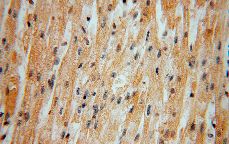 Immunohistochemical of paraffin-embedded human heart using Catalog No:110096(DNAJB5 antibody) at dilution of 1:50 (under 40x lens)
