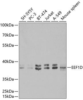 Western blot - EEF1D Polyclonal Antibody 