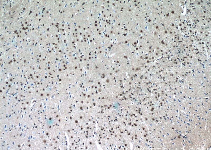 Immunohistochemistry of paraffin-embedded mouse brain tissue slide using Catalog No:115926(TDP-43 Antibody) at dilution of 1:50 (under 10x lens)