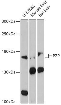 Western blot - PZP Polyclonal Antibody 