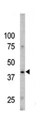 The anti-Phospho-Caspase 9-S196 Pab (Cat. #167023) is used in Western blot to detect Phospho-Caspase 9-S196 in Y79 cell line lysates.