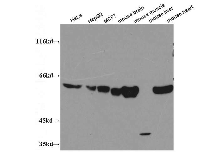 WB result of Catalog No:113859 (PKM antibody) with various lysates.
