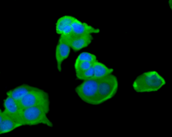 Fig2: ICC staining FPR1 in MCF-7 cells (green). The nuclear counter stain is DAPI (blue). Cells were fixed in paraformaldehyde, permeabilised with 0.25% Triton X100/PBS.
