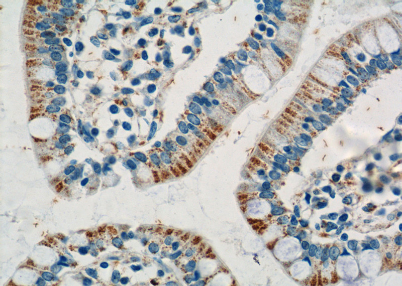 Immunohistochemistry of paraffin-embedded human small intestine tissue slide using Catalog No:108069(ANKRD13D Antibody) at dilution of 1:50 (under 40x lens)