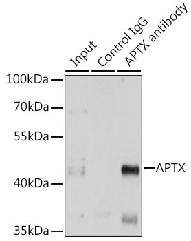 Immunoprecipitation - APTX Polyclonal Antibody 