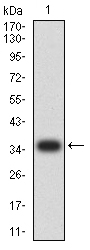 Fig1: Western blot analysis of IGLC2 on human IGLC2 recombinant protein using anti-IGLC2 antibody at 1/1,000 dilution.