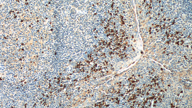 Immunohistochemistry of paraffin-embedded human tonsillitis tissue slide using Catalog No:111119(GPR171 Antibody) at dilution of 1:200 (under 10x lens). heat mediated antigen retrieved with Tris-EDTA buffer(pH9).
