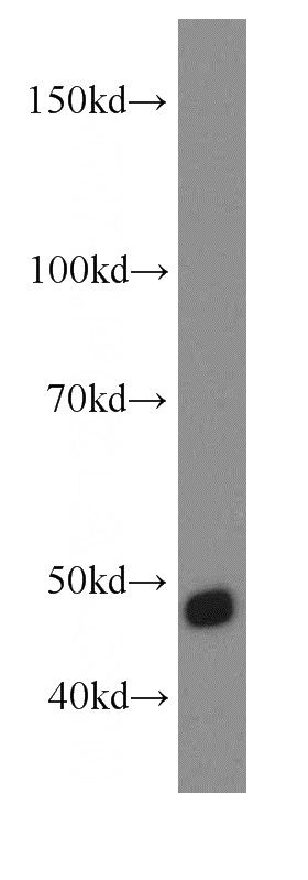 Jurkat cells were subjected to SDS PAGE followed by western blot with Catalog No:116327(TRIP13 antibody) at dilution of 1:400
