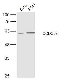 Fig3: Sample:; Siha(Human) Cell Lysate at 40 ug; A549(Human) Cell Lysate at 40 ug; Primary: Anti-CCDC63 at 1/300 dilution; Secondary: IRDye800CW Goat Anti-Rabbit IgG at 1/20000 dilution; Predicted band size: 66/61 kD; Observed band size: 61 kD