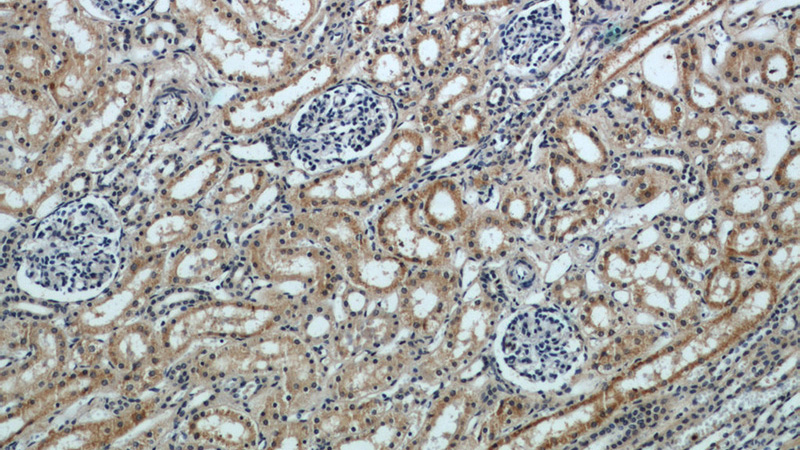 Immunohistochemical of paraffin-embedded human kidney using Catalog No:115357(SLIT2-Specific antibody) at dilution of 1:50 (under 10x lens)
