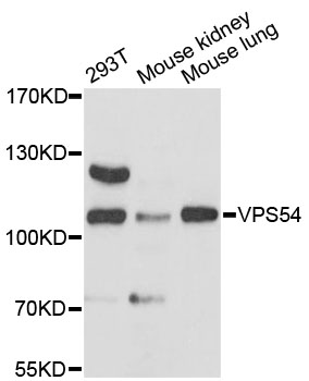 Western blot - VPS54 Polyclonal Antibody 