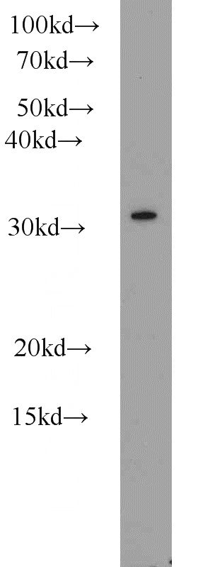 mouse thymus tissue were subjected to SDS PAGE followed by western blot with Catalog No:109406(CLTB antibody) at dilution of 1:1000