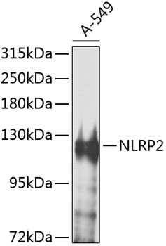 Western blot - NLRP2 Polyclonal Antibody 