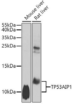 Western blot - TP53AIP1 Polyclonal Antibody 