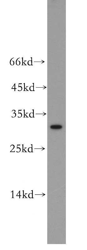 K-562 cells were subjected to SDS PAGE followed by western blot with Catalog No:112225(LILRA5 antibody) at dilution of 1:500