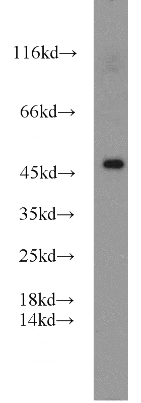 human brain tissue were subjected to SDS PAGE followed by western blot with Catalog No:113573(PANX1 antibody) at dilution of 1:500